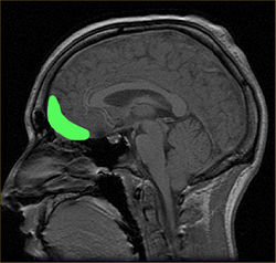 fMRI of orbitofrontal cortex